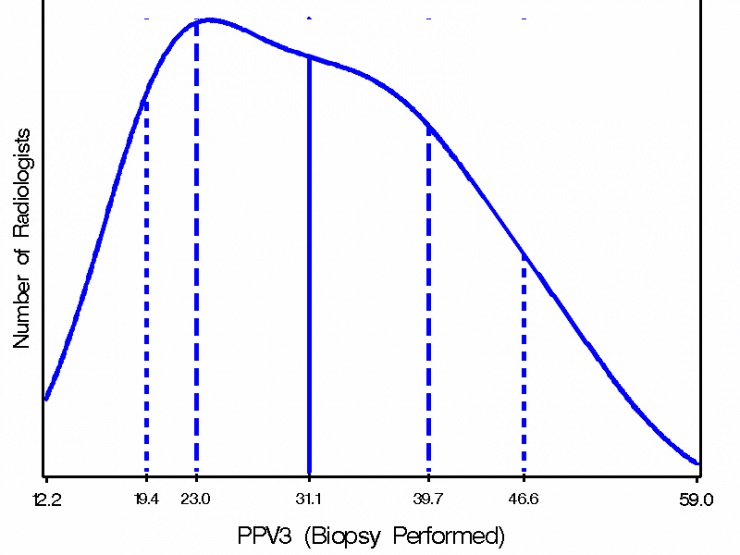 SMOOTHED PLOT OF PPV3Â FREQUENCY DISTRIBUTION Smothed frequency distribution of PPV3; 10th percentile 19.4; 25th percentile 23.0; median 31.1; 75th percentile 39.7; 90th percentile 46.6